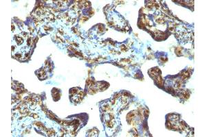 Immunohistochemistry (IHC) image for anti-Moesin (MSN) antibody (ABIN6940085)