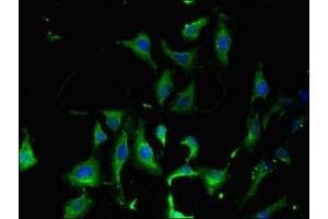 Immunofluorescent analysis of Hela cells using ABIN7158683 at dilution of 1:100 and Alexa Fluor 488-congugated AffiniPure Goat Anti-Rabbit IgG(H+L) (KARS 抗体  (AA 101-400))