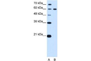 WB Suggested Anti-DTX2 Antibody Titration:  0. (DTX2 抗体  (C-Term))