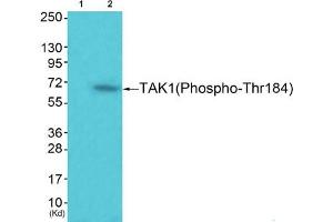 Western blot analysis of extracts from 293 cells (Lane 2), using TAK1 (Phospho-Thr184) Antibody. (MAP3K7 抗体  (pThr184))