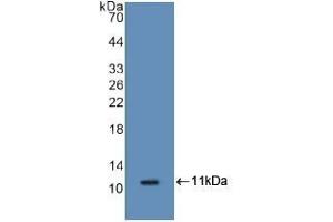 Detection of Recombinant S100A8, Mouse using Polyclonal Antibody to S100 Calcium Binding Protein A8 (S100A8) (S100A8 抗体  (AA 1-89))