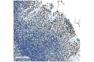 IHC analysis of NRF1 using anti- NRF1 antibody (ABIN7600874).