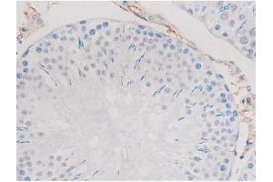ABIN6267487 at 1/200 staining Rat testis tissue sections by IHC-P. (alpha Adducin 抗体  (pSer726))