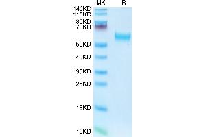 SDS-PAGE (SDS) image for Interleukin 18 Receptor Accessory Protein (IL18RAP) (AA 20-356) protein (His tag) (ABIN7274980)