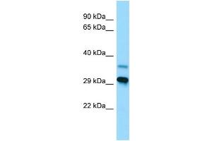 WB Suggested Anti-LYPLAL1 Antibody Titration: 1. (LYPLAL1 抗体  (C-Term))