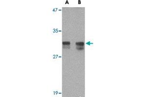 Western blot analysis of RASD2 in rat colon tissue lysate with RASD2 polyclonal antibody  at (A) 1 and (B) 2 ug/mL . (RASD2 抗体  (N-Term))