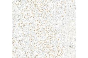 Immunohistochemistry (IHC) image for anti-Androgen Receptor (AR) (AA 1-50) antibody (ABIN7454995) (Androgen Receptor 抗体  (AA 1-50))