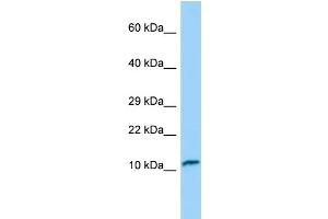 Western Blotting (WB) image for anti-Fast Skeletal Troponin C (TNNC2) (N-Term) antibody (ABIN2790315) (TNNC2 抗体  (N-Term))