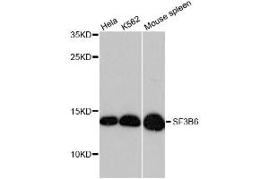 Western blot analysis of extracts of various cell lines, using SF3B6 antibody (ABIN6290152) at 1:3000 dilution. (Pre-mRNA Branch Site Protein p14 (SF3B14) 抗体)