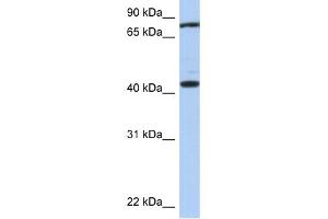 WB Suggested Anti-TEX9 Antibody Titration: 0. (TEX9 抗体  (Middle Region))