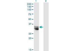 Western Blot analysis of NIT1 expression in transfected 293T cell line by NIT1 monoclonal antibody (M01), clone 1C3. (Nitrilase 1 抗体  (AA 228-327))