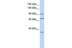 EEF2 antibody used at 1 ug/ml to detect target protein. (EEF2 抗体  (N-Term))