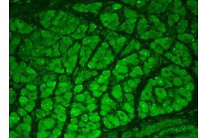 Immunofluorescence (IF) image for anti-Calcium/calmodulin-Dependent Protein Kinase II alpha (CAMK2A) antibody (ABIN6658262)