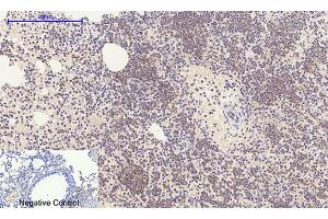 Immunohistochemical analysis of paraffin-embedded mouse lung tissue. (E2F1 抗体  (AA 100-170))