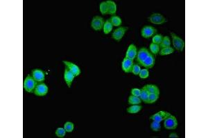Immunofluorescent analysis of PC-3 cells using ABIN7170309 at dilution of 1:100 and Alexa Fluor 488-congugated AffiniPure Goat Anti-Rabbit IgG(H+L) (SSTR2 抗体  (AA 304-369))