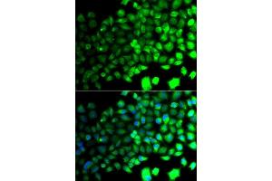 Immunofluorescence analysis of A549 cells using PRKAA2 antibody. (PRKAA2 抗体  (AA 343-552))