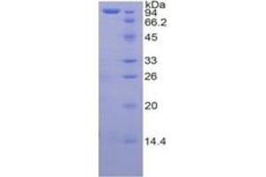 SDS-PAGE (SDS) image for Transglutaminase 2 (C Polypeptide, Protein-Glutamine-gamma-Glutamyltransferase) (TGM2) ELISA Kit (ABIN6574289)