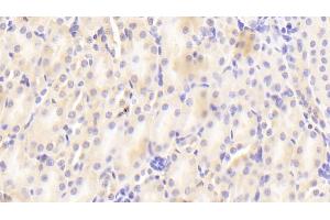 Detection of CRAT in Mouse Kidney Tissue using Polyclonal Antibody to Carnitine Acetyltransferase (CRAT) (CRAT 抗体  (AA 1-430))