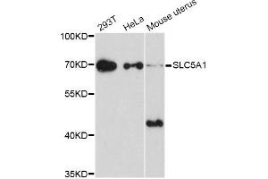 Western blot analysis of extracts of various cell lines, using SLC5A1 Antibody (ABIN5998870) at 1/1000 dilution. (SLC5A1 抗体)