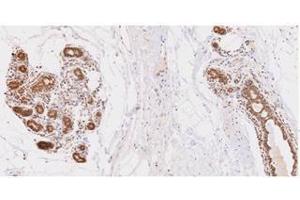 Immunohistochemistry (IHC) image for anti-Ubiquitin-Conjugating Enzyme E2L 6 (UBE2L6) (AA 1-152), (N-Term) antibody (ABIN317574) (UBE2L6 抗体  (N-Term))