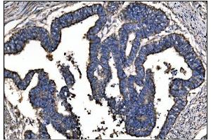 IHC analysis of Ornithine Aminotransferase/OAT using anti-Ornithine Aminotransferase/OAT antibody (ABIN7600649). (OAT 抗体  (AA 214-439))