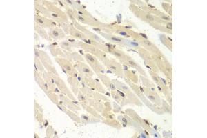 Immunohistochemistry of paraffin-embedded mouse heart using PSME1 antibody (ABIN1876546) at dilution of 1:100 (40x lens). (PSME1 抗体)
