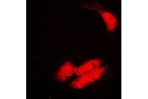Immunofluorescent analysis of SULT2B1 staining in A549 cells. (SULT2B1 抗体)
