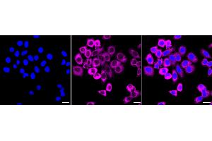 anti-Fragile X Messenger Ribonucleoprotein 1 antibody