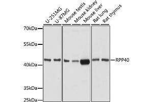 Western blot analysis of extracts of various cell lines, using RPP40 antibody (ABIN7269984) at 1:1000 dilution.