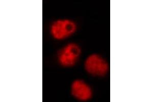 ABIN6268905 staining HeLa by IF/ICC. (OCT4 抗体  (Internal Region))
