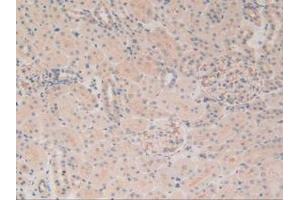 Figure. (MAP4 抗体  (AA 2-250))