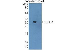 Detection of Recombinant BNC1, Human using Polyclonal Antibody to Basonuclin 1 (BNC1) (Basonuclin 1 抗体  (AA 43-246))