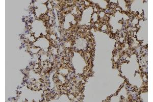 ABIN6268990 at 1/100 staining Mouse lung tissue by IHC-P. (PPP1R12A 抗体  (C-Term))