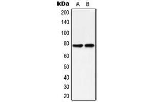 Western blot analysis of PKC delta (pY313) expression in HeLa (A), MCF7 Caylculin A-treated (B) whole cell lysates. (PKC delta 抗体  (pTyr313))