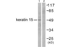 Western blot analysis of extracts from COS7 cells, using Keratin 15 antibody (ABIN5976435). (KRT15 抗体  (N-Term))