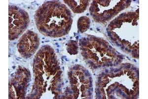 Immunohistochemical staining of paraffin-embedded Human breast tissue using anti-EPN2 mouse monoclonal antibody. (Epsin 2 抗体)