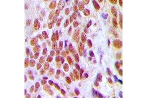 Immunohistochemistry (IHC) image for anti-High Mobility Group Box 2 (HMGB2) antibody (ABIN7302748)