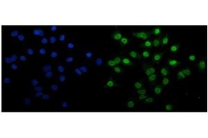 anti-Ankyrin Repeat-Containing Protein (EHMT2) (AA 580-1195) antibody