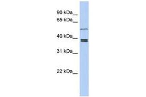 Image no. 1 for anti-Synovial Sarcoma Translocation Gene On Chromosome 18-Like 1 (SS18L1) (AA 251-300) antibody (ABIN6743926) (SS18L1 抗体  (AA 251-300))
