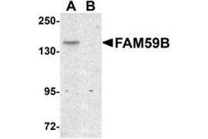 Western blot analysis of FAM59B in SK-N-SH cell lysate with AP30331PU-N FAM59B antibody at 1 μg/ml in (A) the absence and (B) the presence of blocking peptide. (FAM59B 抗体  (C-Term))