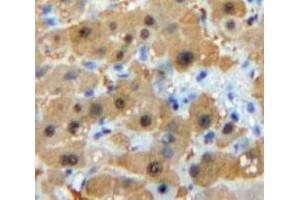 Immunohistochemistry (IHC) image for anti-Prostaglandin E Synthase 2 (PTGES2) (AA 144-384) antibody (ABIN1860350)