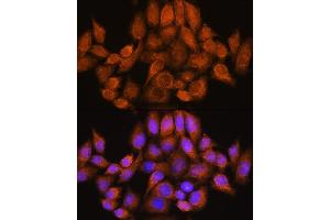 Immunofluorescence analysis of HeLa cells using  Rabbit pAb (ABIN7269965) at dilution of 1:100. (ARHGAP30 抗体  (AA 485-585))