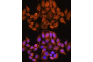 Immunofluorescence analysis of HeLa cells using  Rabbit pAb (ABIN7269965) at dilution of 1:100. (ARHGAP30 抗体  (AA 485-585))