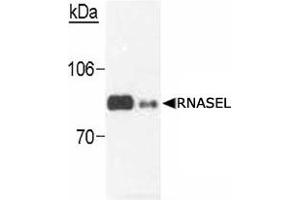 Western blot analysis of RNASEL in transfected cells (0. (RNASEL 抗体)