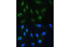 Immunofluorescence analysis of H9C2 cells using NBAS Rabbit pAb (ABIN1680973, ABIN3019188, ABIN3019189 and ABIN6220752) at dilution of 1:100. (NBAS 抗体  (AA 1-70))
