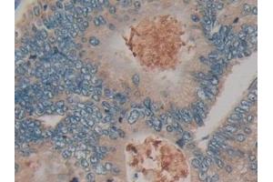Immunohistochemistry (IHC) image for anti-Kallikrein 10 (KLK10) (AA 35-276) antibody (ABIN7429862)