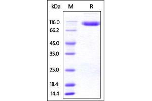 Human DPPIV, His Tag on SDS-PAGE under reducing (R) condition. (DPP4 Protein (AA 34-766) (His tag))