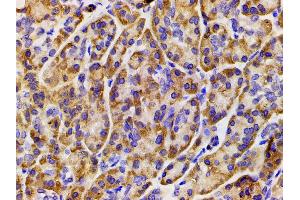 Immunohistochemistry (IHC) image for anti-Phosphoinositide 3 Kinase, p85 alpha (PI3K p85a) (pTyr607) antibody (ABIN6256775)