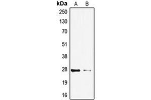 Western blot analysis of TP53INP1 expression in HeLa (A), HepG2 (B) whole cell lysates. (TP53INP1 抗体  (C-Term))