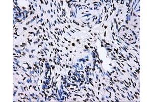 Image no. 10 for anti-RalA Binding Protein 1 (RALBP1) antibody (ABIN1500585)